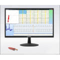 Holter Ecg 24 Hours